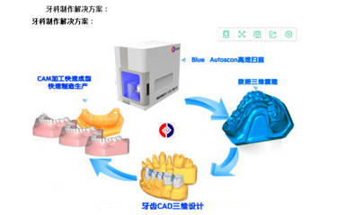牙齒三維掃描儀 重塑口腔醫(yī)療與技術(shù)服務(wù)新體驗